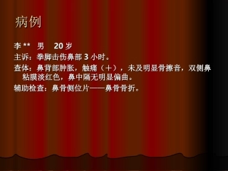 鼻骨骨折(1)