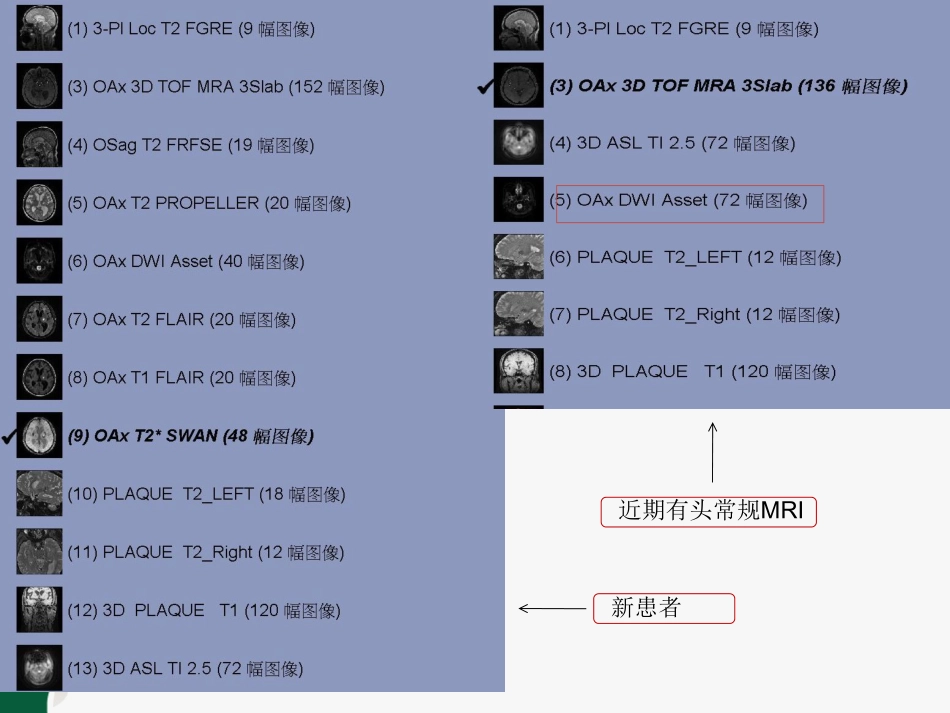 高分辨MR颅内动脉管壁成像技术——检查方案及成像参数_第3页