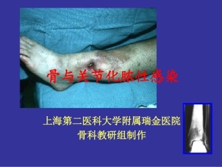 骨与关节化脓性感染