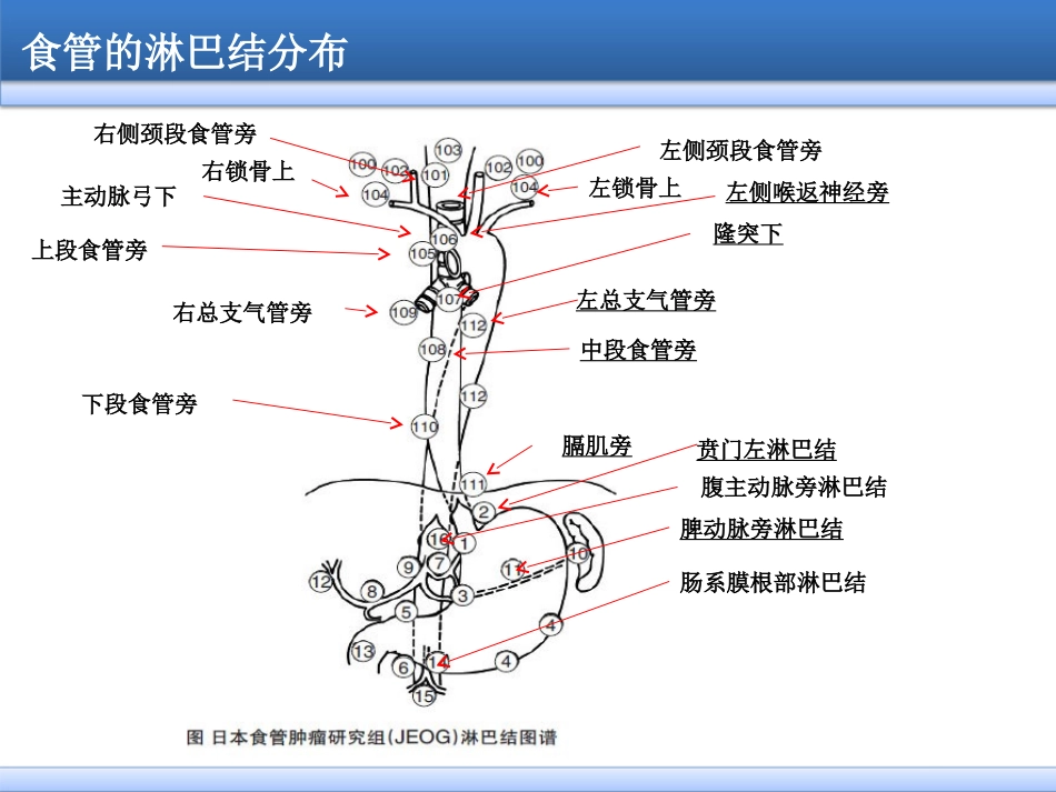 食管癌淋巴结三野清扫_第2页