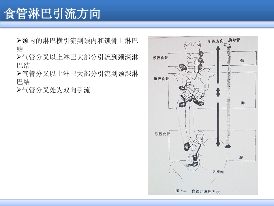 食管癌淋巴结三野清扫_第3页