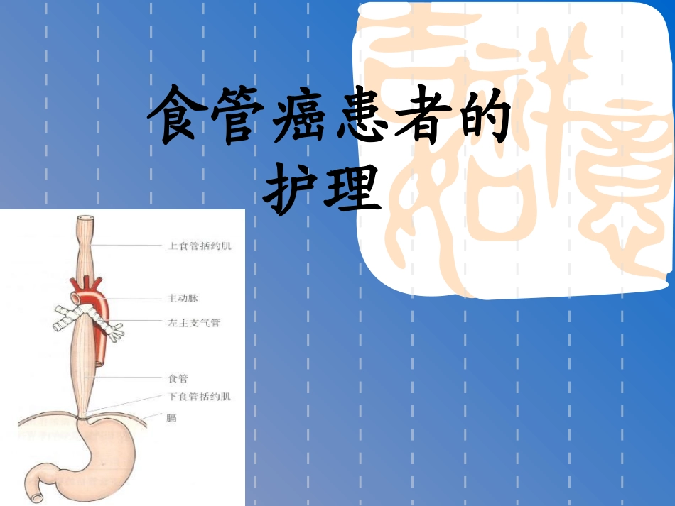 食管癌患者的_第1页