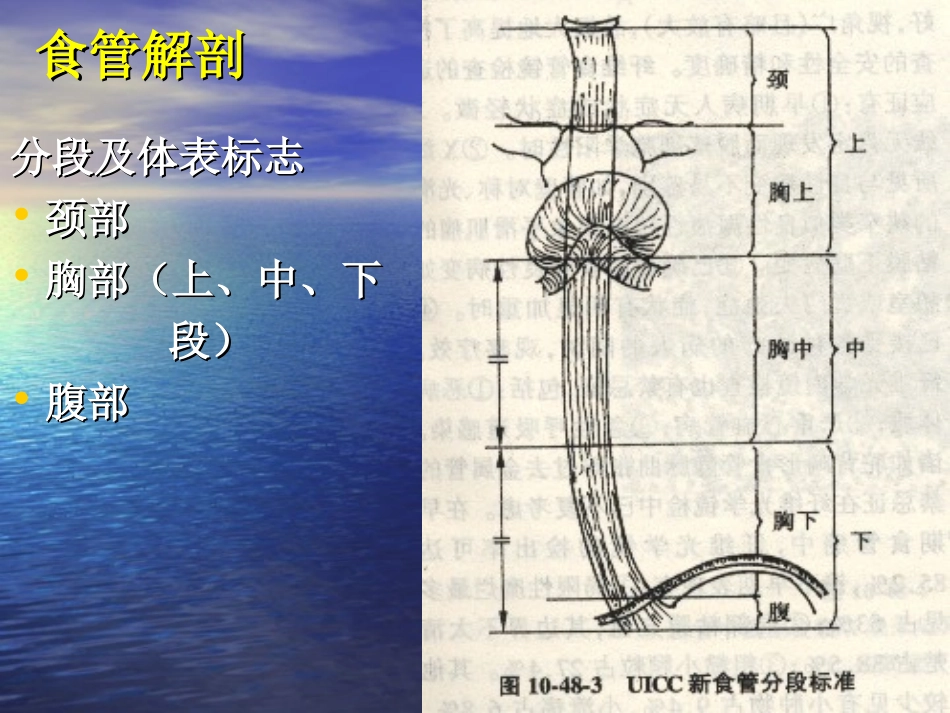 食管癌-讲课-李猛_第3页
