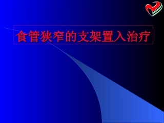 食管狭窄的支架置入治疗