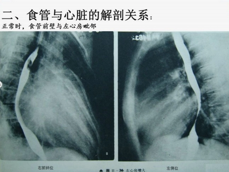 食管心脏调博应用基础_第3页