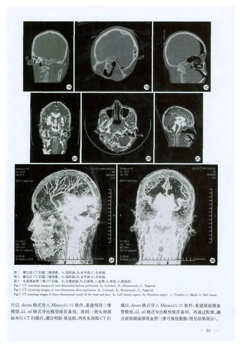颌面部血管的三维可视化_第2页