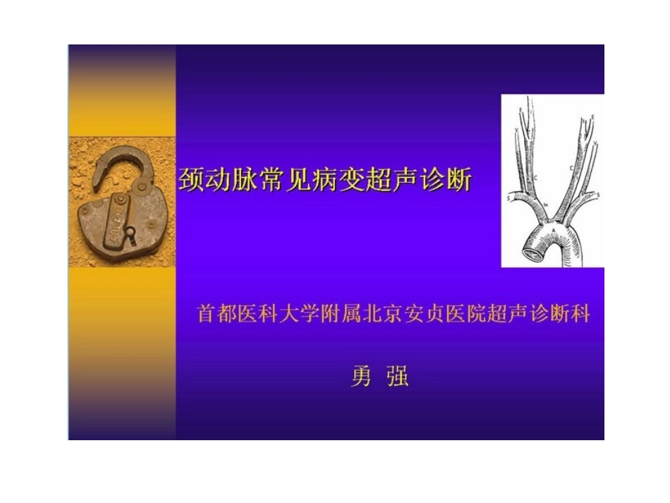 颈动脉血管超声诊断nt 演示文稿_第2页