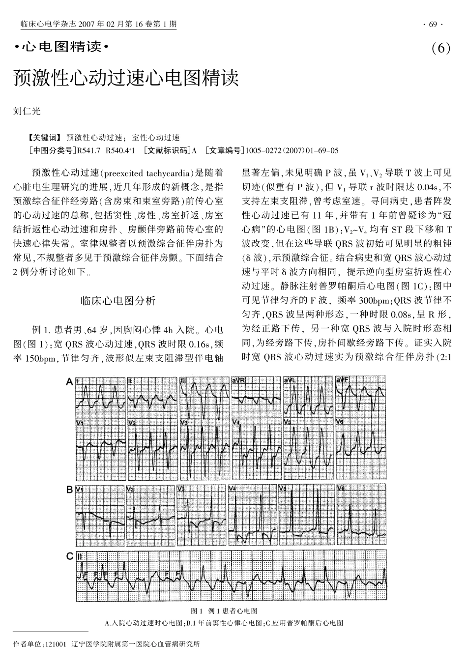 预激性心动过速心电图精读_第1页