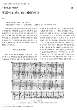 预激性心动过速心电图精读