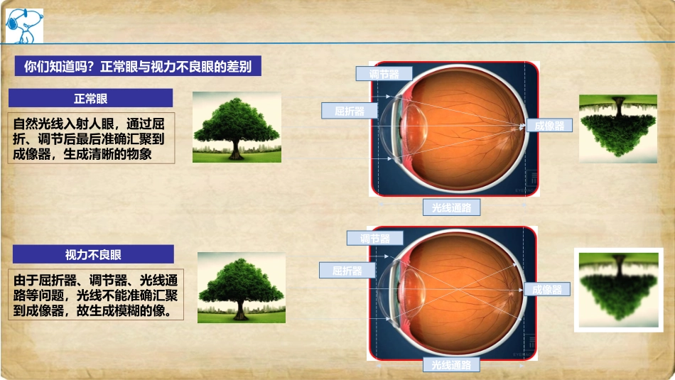青少年近视眼的形成与发展上传_第3页