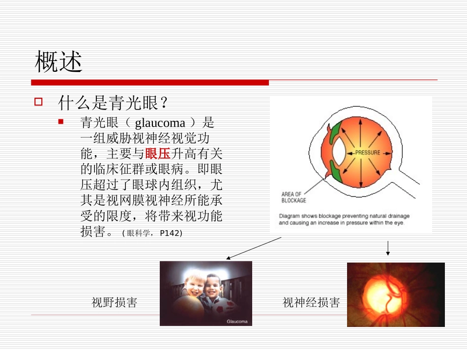 青光眼讲课-王宁利_第3页