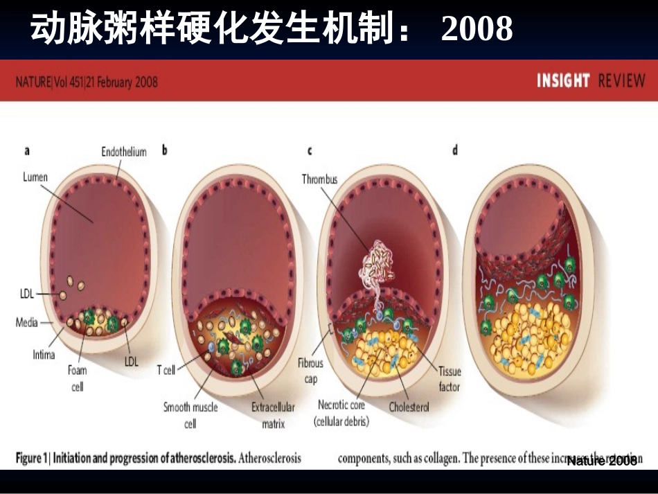 降胆固醇治疗的新思路_第3页