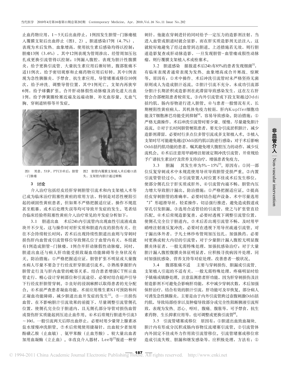 阻塞性黄疸介入治疗的并发症分析_第2页