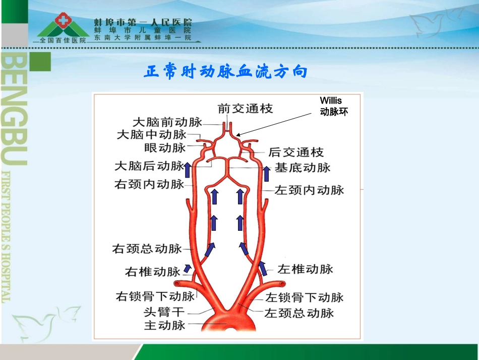 锁骨下动脉盗血综合征详解_第3页