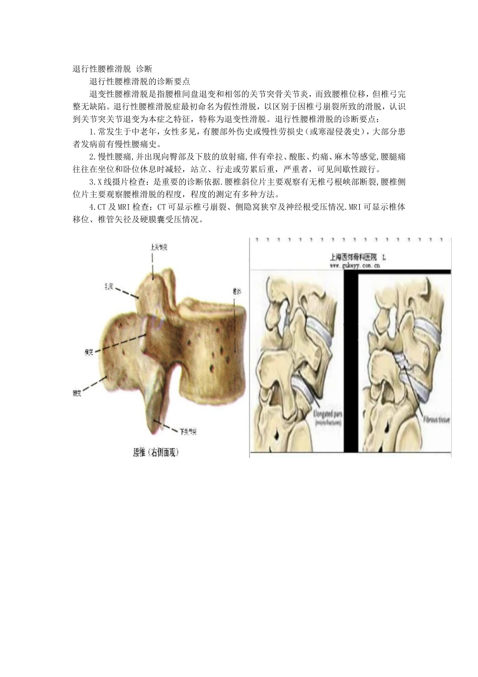 退行性腰椎滑脱症诊断_第1页