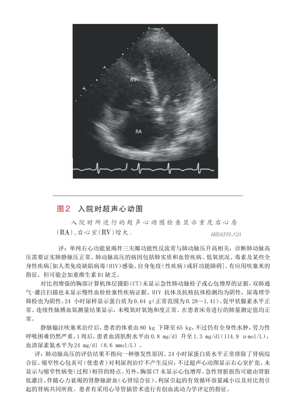 边说边解阵发性夜间呼吸困难一例_第3页