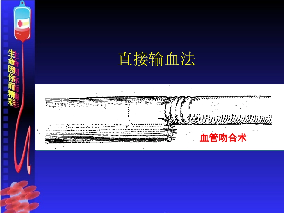 输血严重危害(SHOT)_第3页