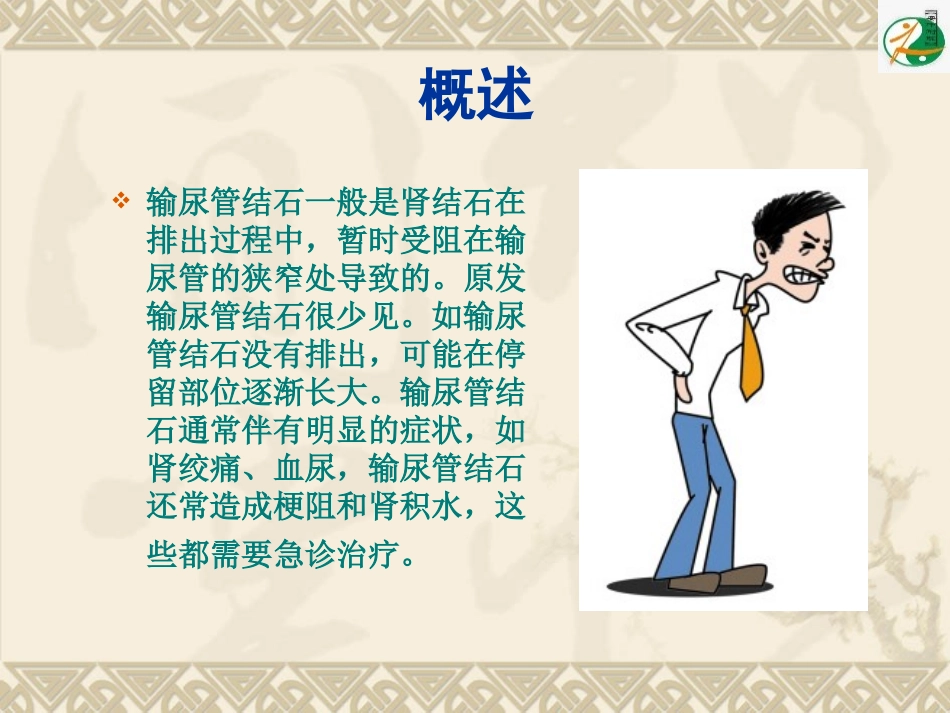 输尿管结石及钬激光碎石术_第2页