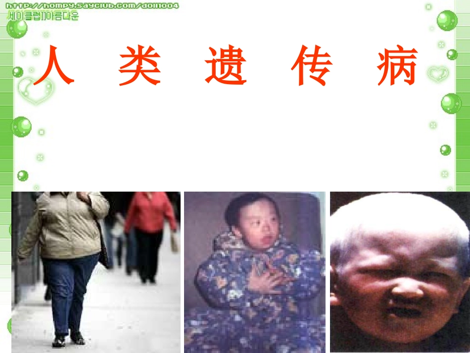 软骨发育不全染色体性遗传病_第1页