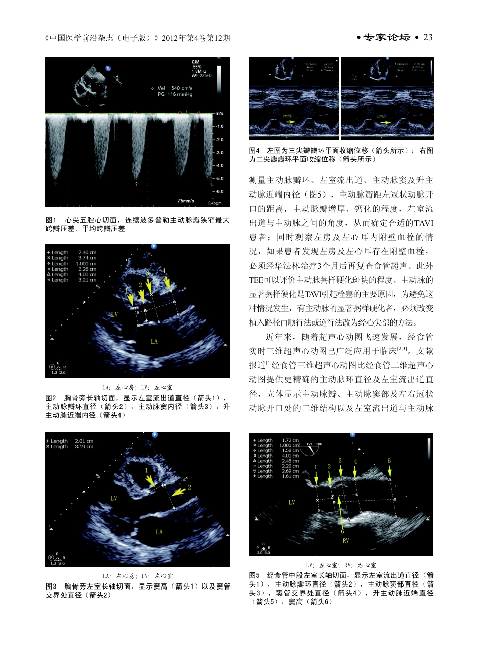 超声心动图在经导管主动脉瓣置入术中的应用价值_第2页