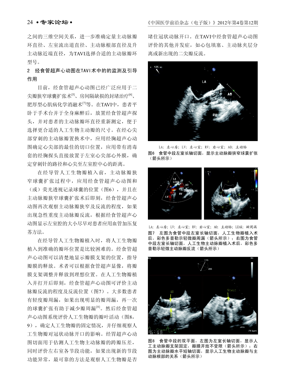 超声心动图在经导管主动脉瓣置入术中的应用价值_第3页