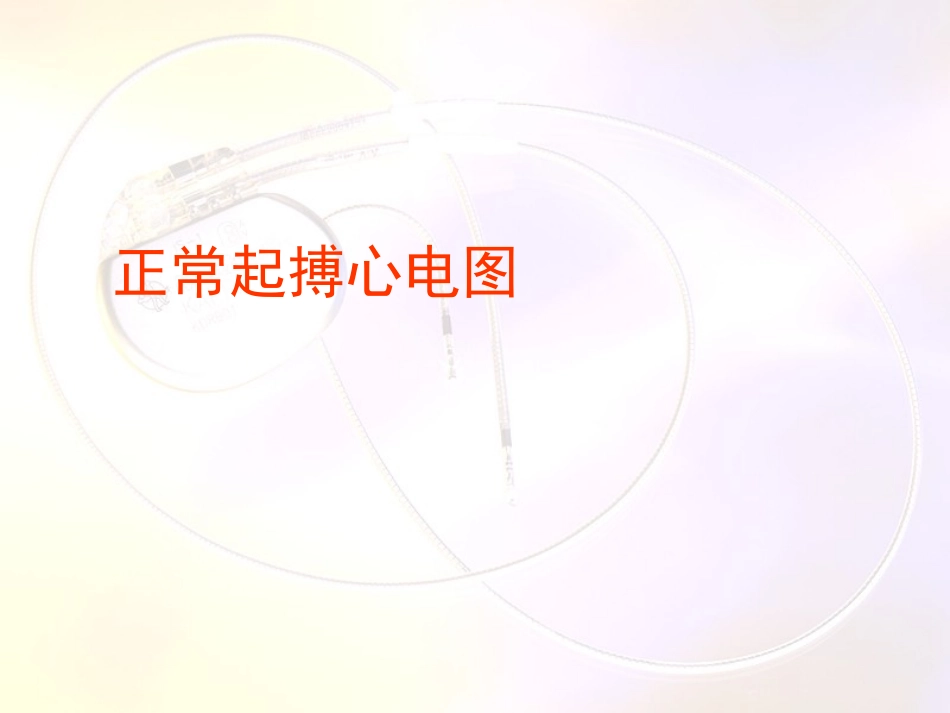 起搏器心电图1_第2页