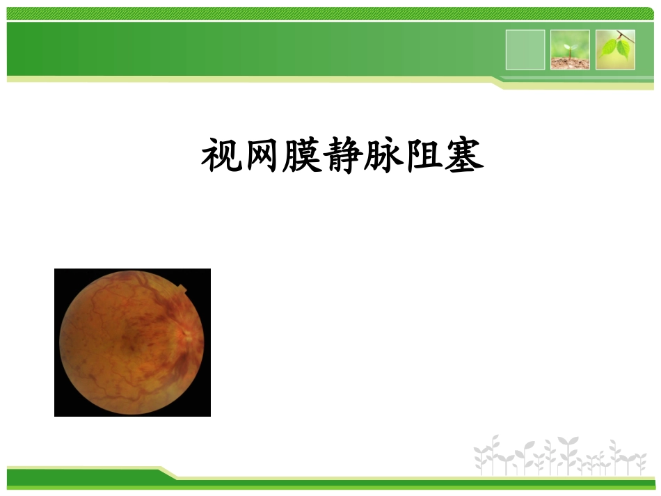 视网膜静脉阻塞_第1页