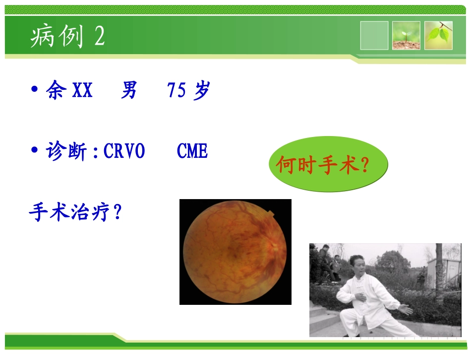 视网膜静脉阻塞_第3页