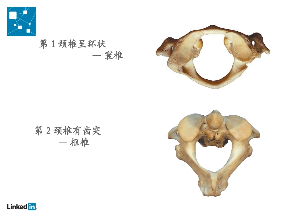 被让颈椎病降低你的工作效率_第2页