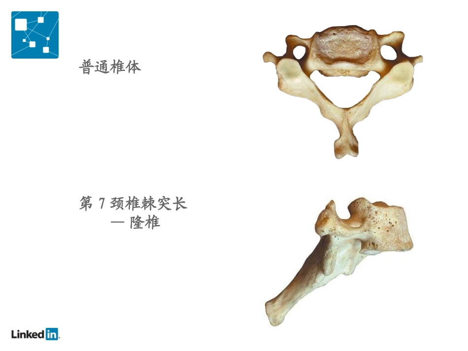 被让颈椎病降低你的工作效率_第3页