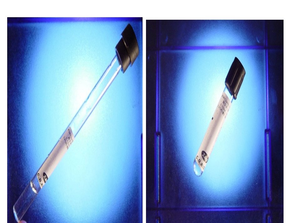 血液标本的正确采集_第3页