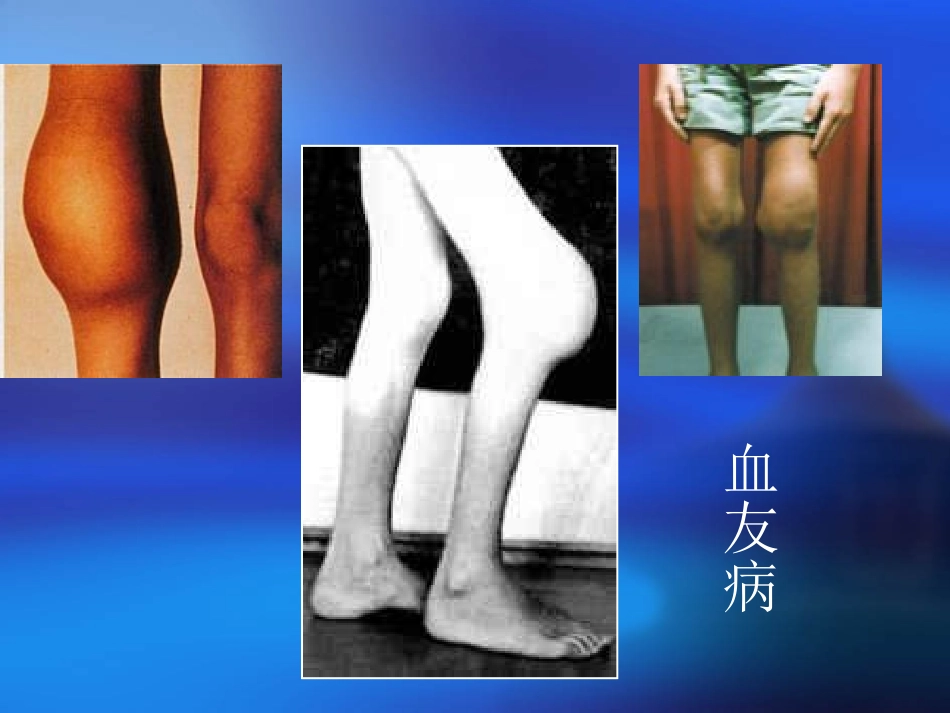 血栓与止血检测.._第2页