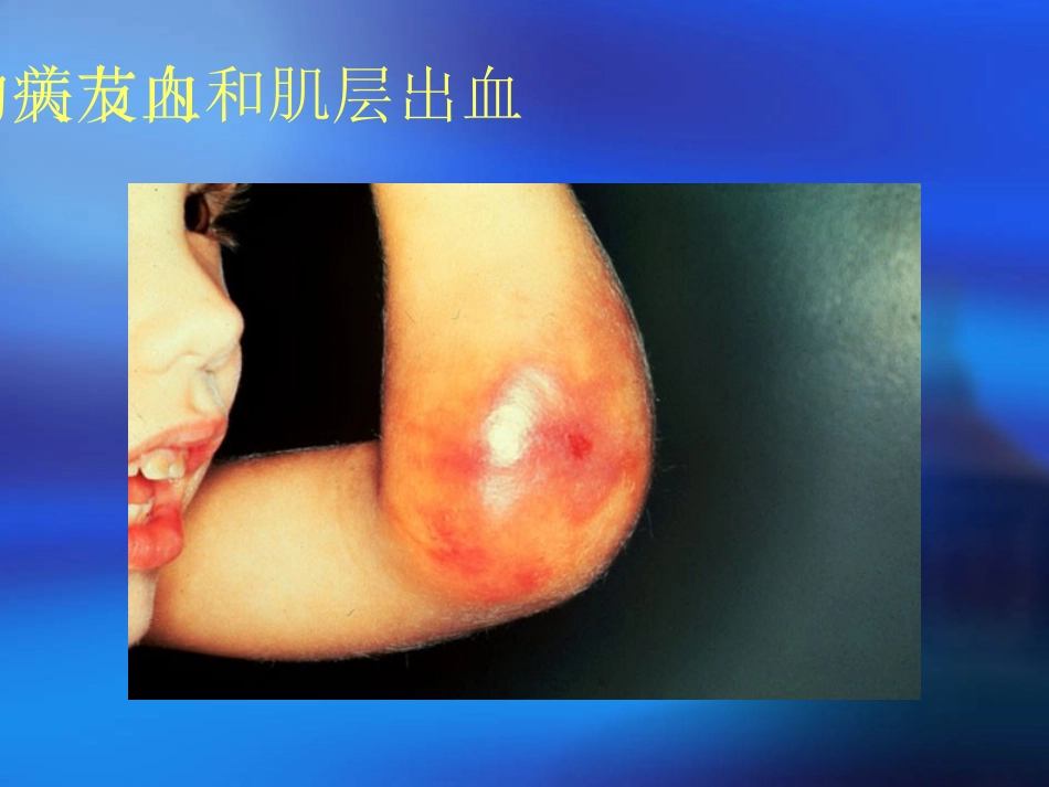 血栓与止血检测.._第3页