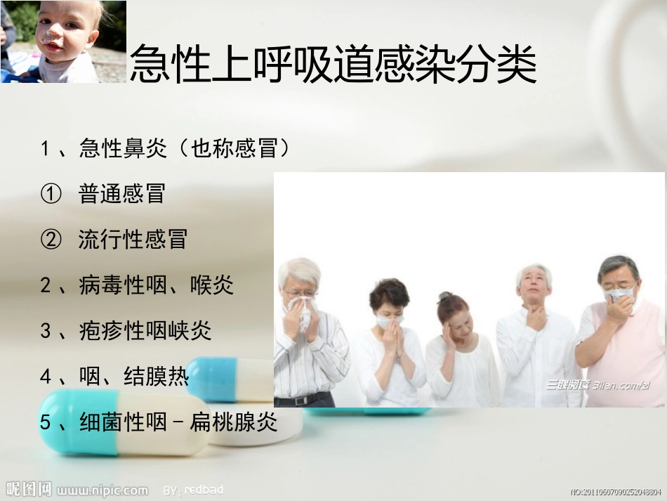 药学服务技术案例分析-急性上呼吸道感染_第3页