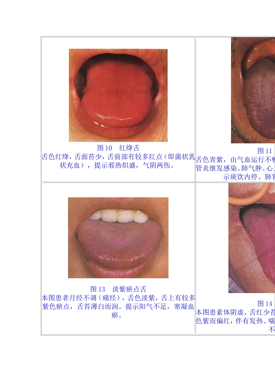 舌苔望诊图谱集_第3页