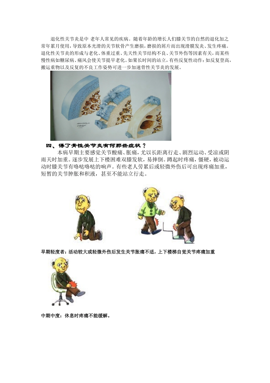 膝关节骨性关节炎的健康知识问答讲解_第2页