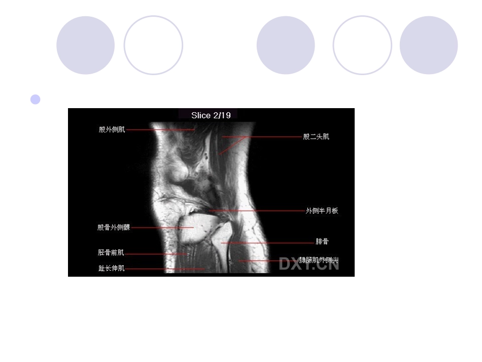 膝关节MRI[1].pptb_第3页