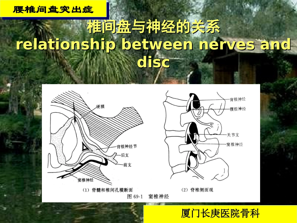 腰腿痛-Low-Back-Pain---厦门长庚医院---XIAMEN-CHANG_第3页