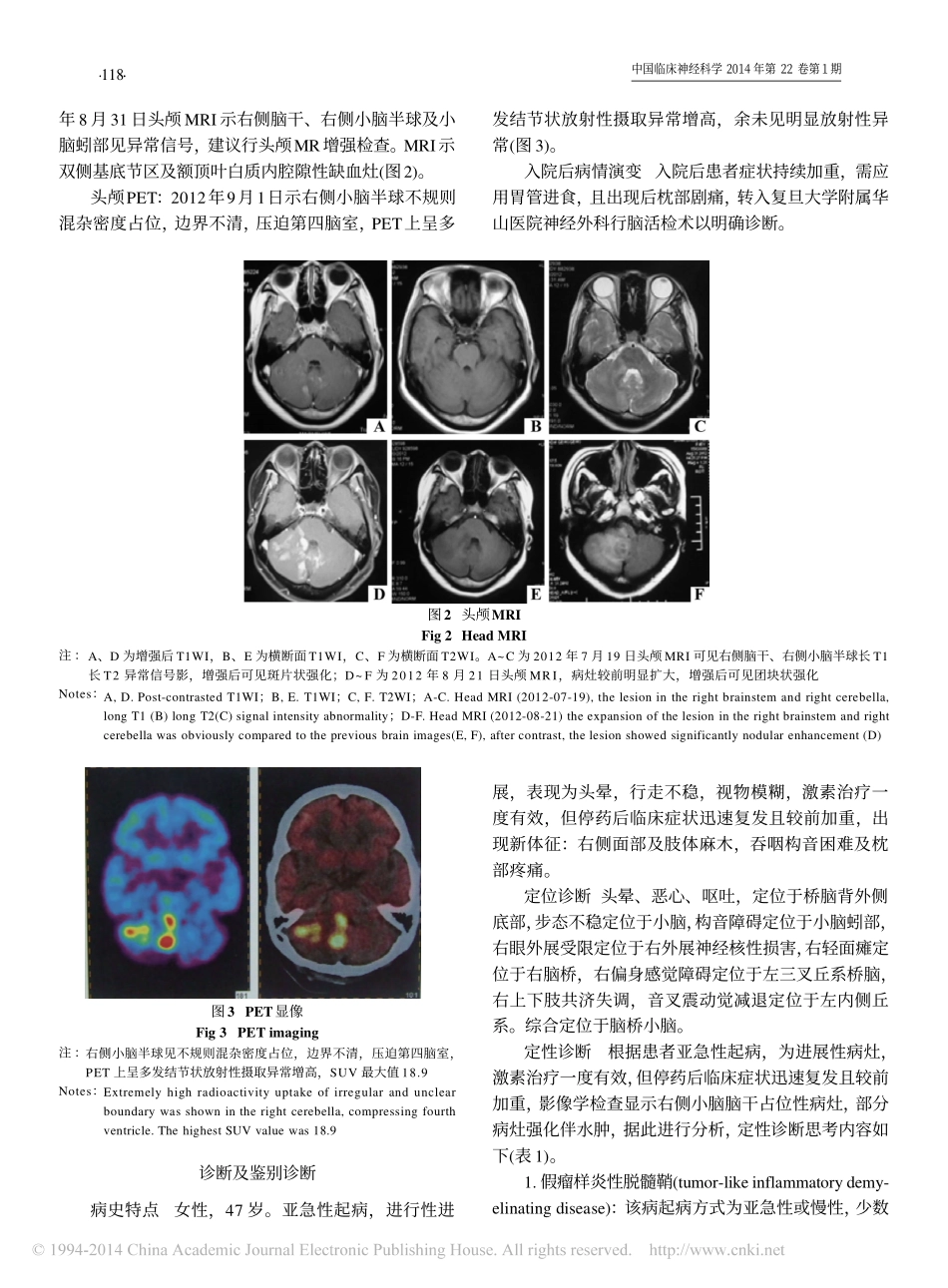 脑干小脑占位1例临床病例讨论_薛元媛_赵重波_陈宏_王蓓_李颖_第2页