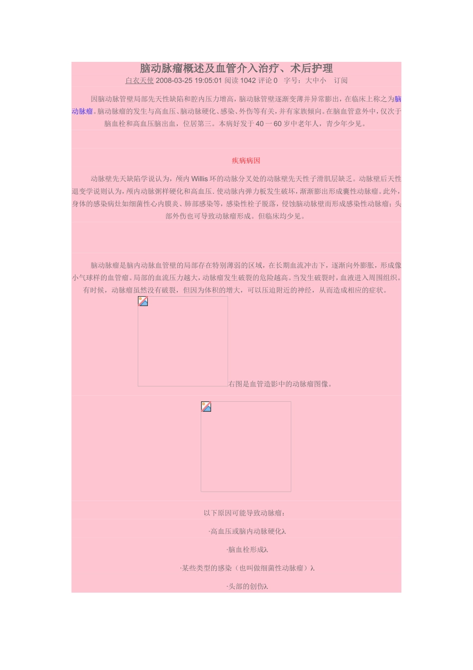 脑动脉瘤概述及血管介入治疗-2_第1页