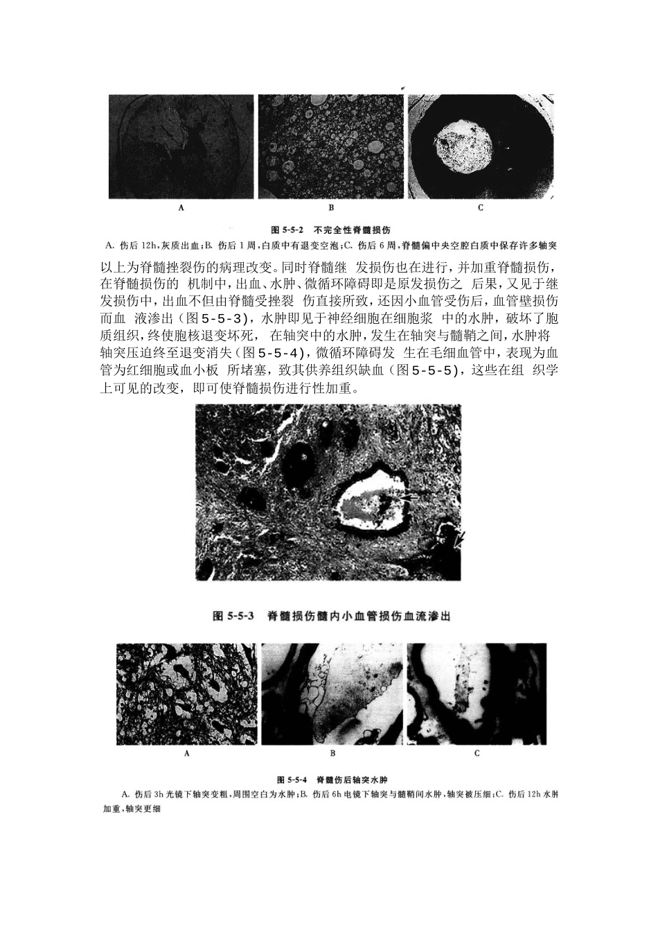脊髓损伤的病理改变_第2页