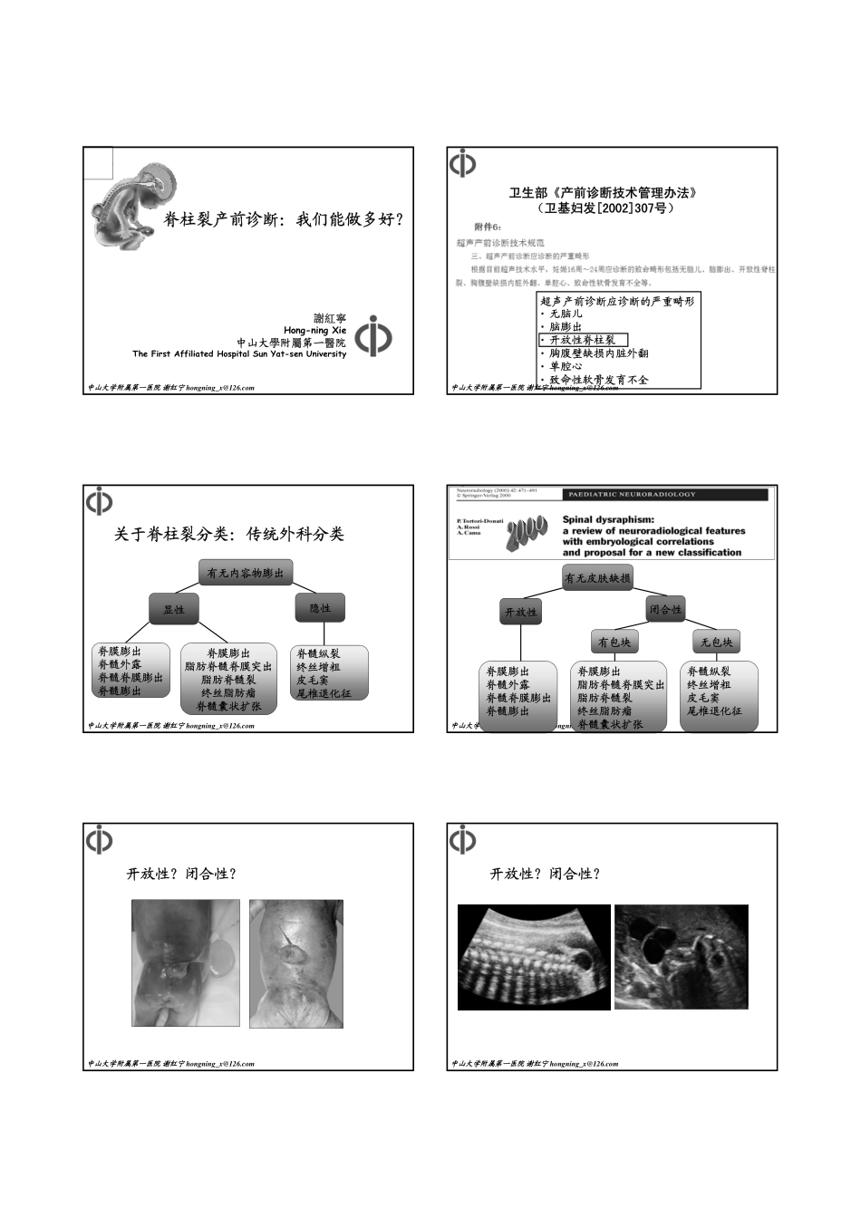 脊柱裂谢红宁 简单讲义_第1页
