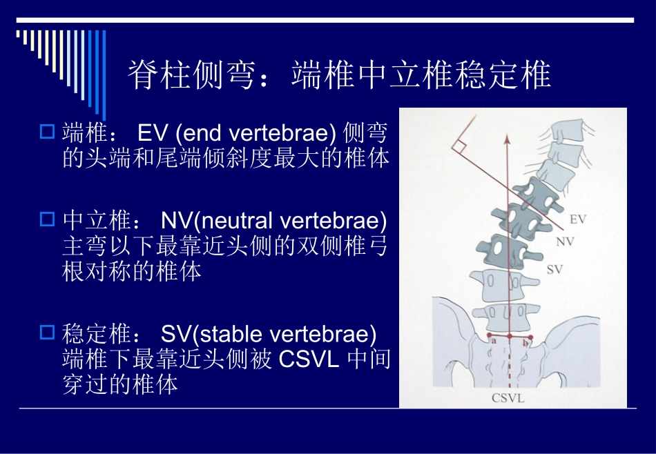 脊柱侧弯基础知识_第2页