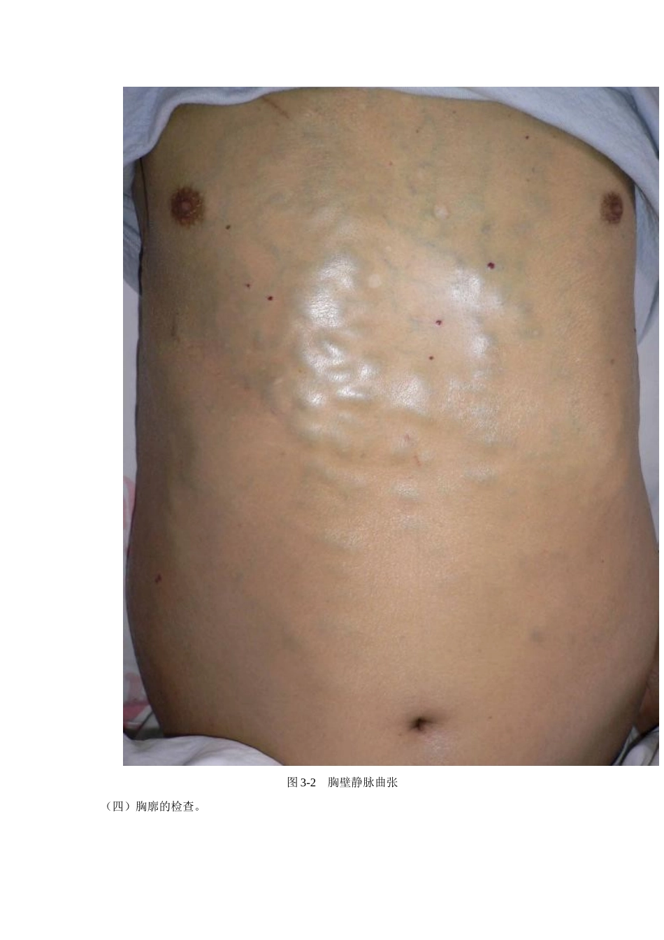 胸廓和肺部检查_第3页