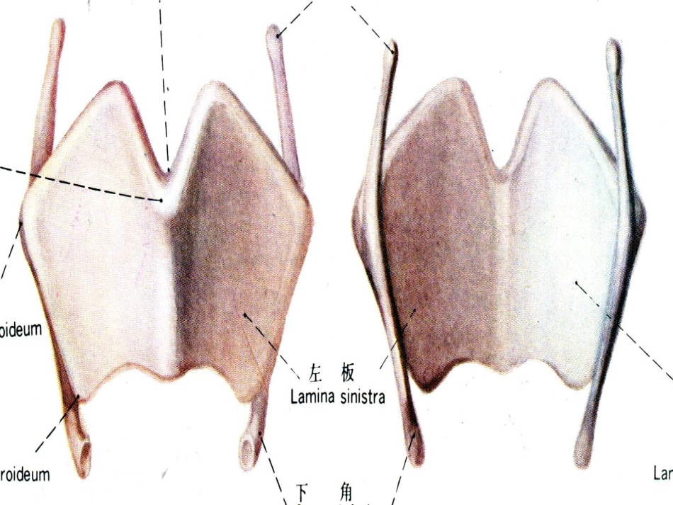 胸片广医一院_第3页