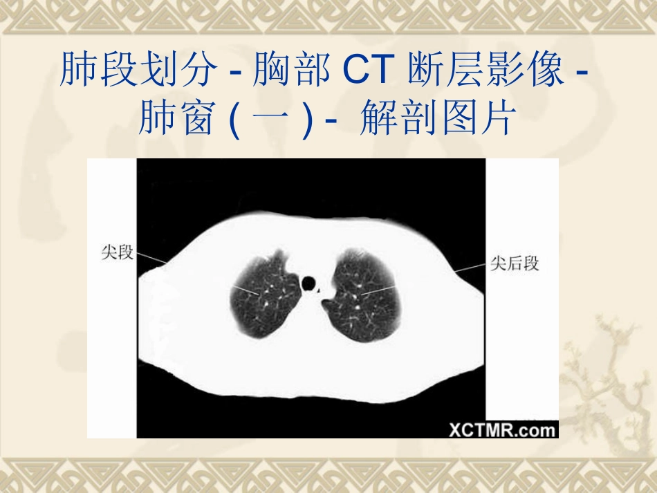 胸、上腹和盆腔CT详细实用图解_第3页