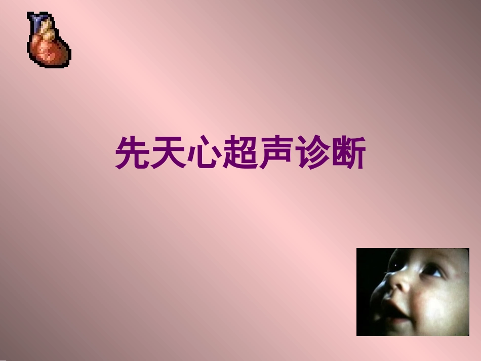 胎儿超声心动图.ppt_第1页
