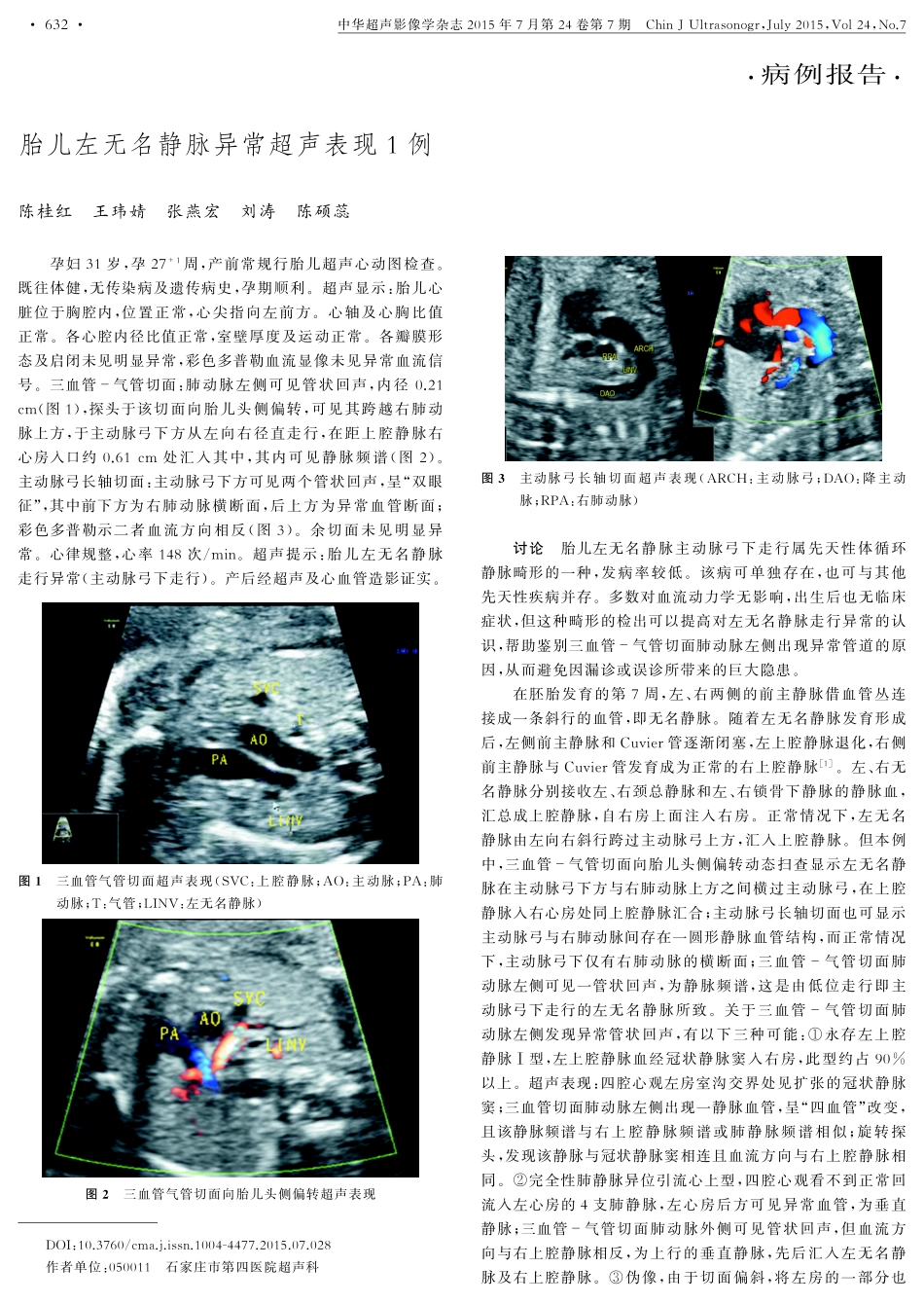 胎儿左无名静脉异常超声表现1例_第1页