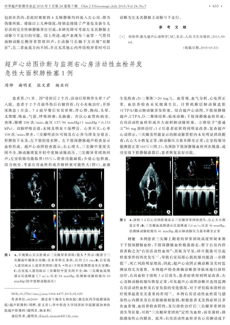 胎儿左无名静脉异常超声表现1例_第2页