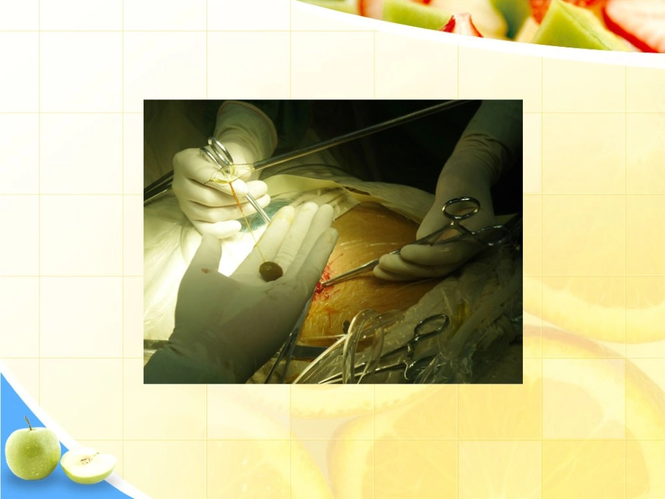 胆结石食疗方法总结_第2页